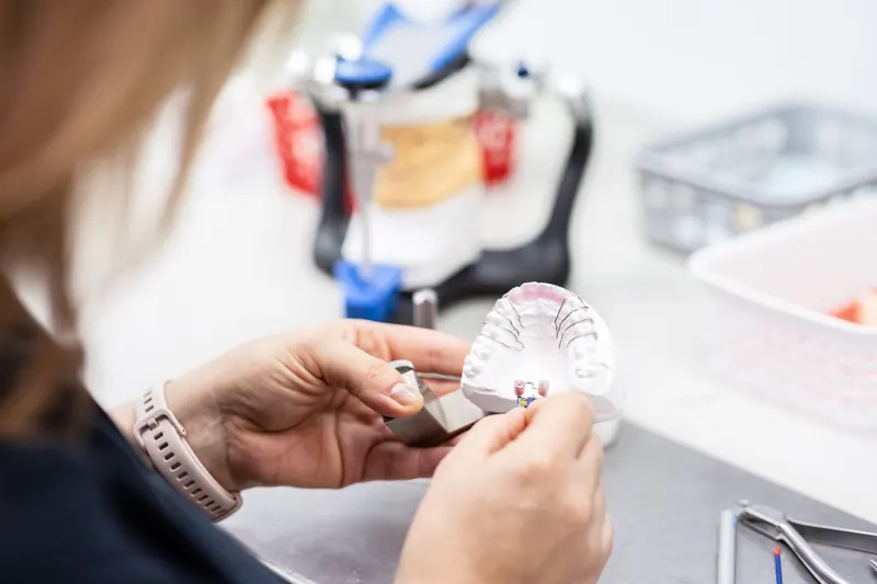 Detailaufnahme eines Zahnmodells in der Hand